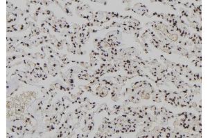 ABIN6266065 and ABIN6278212 at 1/100 staining Human lung tissue by IHC-P. (XPO4 抗体  (N-Term))