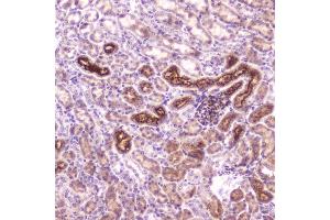 IHC analysis of IGFBP2 using anti-IGFBP2 antibody (ABIN5693239).