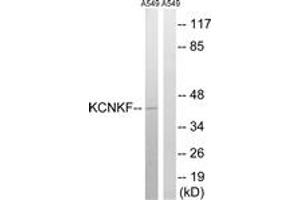 Western blot analysis of extracts from A549 cells, using KCNK15 Antibody. (KCNK15 抗体  (AA 273-322))