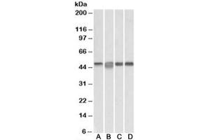 Western blot testing of Daudi [A], Jurkat [B], K562 [C] and MOLT4 [D] lysates with MAP2K2 antibody at 0. (MEK2 抗体)