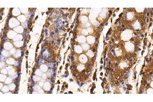 Detection of Surv in Porcine Colon Tissue using Monoclonal Antibody to Survivin (Surv) (Survivin 抗体  (AA 1-142))