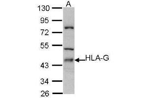 WB Image Sample (30 ug of whole cell lysate) A: Molt-4 , 10% SDS PAGE antibody diluted at 1:500 (HLAG 抗体)