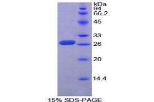 SDS-PAGE analysis of Mouse Sp100 Nuclear Antigen Protein. (SP100 蛋白)