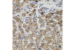 Immunohistochemistry of paraffin-embedded human liver injury using NTF3 antibody. (Neurotrophin 3 抗体  (AA 19-257))