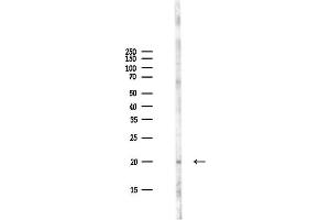 Western blot analysis of lysates from PC12 cells(LPS,4h treatment), using Acetyl-Histone H3 (Lys9) Antibody at 1/1000 dilution.