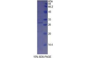 SDS-PAGE analysis of Pig Tyrosinase Protein. (TYR 蛋白)