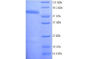 SDS-PAGE (SDS) image for Receptor-Interacting serine-threonine Kinase 3 (RIPK3) (AA 1-486), (full length) protein (His tag) (ABIN5714502) (RIPK3 Protein (AA 1-486, full length) (His tag))