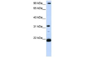 WB Suggested Anti-SNF8 Antibody Titration: 0. (SNF8 抗体  (C-Term))