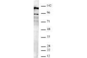 JMJD2B / KDM4B antibody (rAb) tested by Western blot. (Recombinant KDM4B 抗体)