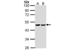 WB Image Sample (30 ug of whole cell lysate) A: 293T B: A431 , 10% SDS PAGE antibody diluted at 1:5000 (FH 抗体)