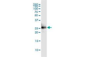 CITED1 monoclonal antibody (M02), clone 6C1.