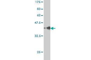 Western Blot detection against Immunogen (38. (TRAF3IP2 抗体  (AA 451-565))