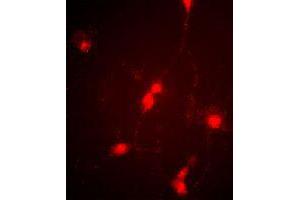Immunofluorescence image of cultured chick retinal amacrine (neuronal) cells labeled with CLCN4 polyclonal antibody . (CLCN4 抗体  (C-Term))