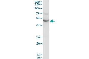 ENO1 polyclonal antibody (A01), Lot # SFU4050831QCS1. (ENO1 抗体  (AA 1-434))