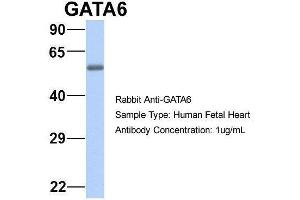 Host:  Rabbit  Target Name:  GATA6  Sample Type:  Human Fetal Heart  Antibody Dilution:  1. (GATA6 抗体  (N-Term))