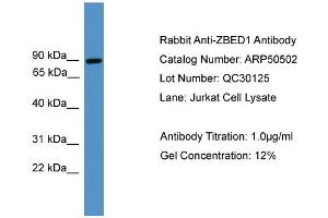 Western Blotting (WB) image for anti-Zinc Finger, BED-Type Containing 1 (ZBED1) (C-Term) antibody (ABIN2784207)