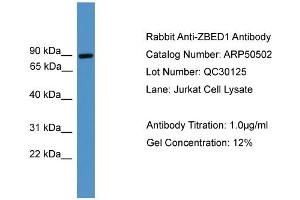 WB Suggested Anti-ZBED1  Antibody Titration: 0. (ZBED1 抗体  (C-Term))