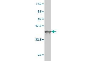 Western Blotting (WB) image for anti-DEAD (Asp-Glu-Ala-Asp) Box Polypeptide 41 (DDX41) (AA 523-622) antibody (ABIN565608)