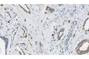 anti-rho GTPase Activating Protein 25 (ARHGAP25) (Internal Region) antibody