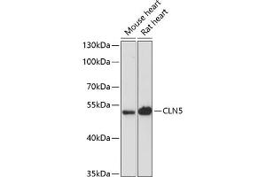 Western blot analysis of extracts of various cell lines, using CLN5 antibody (ABIN6133293, ABIN6138735, ABIN6138736 and ABIN6216682) at 1:3000 dilution. (CLN5 抗体  (AA 96-407))