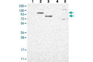 Western blot analysis of Lane 1: RT-4, Lane 2: U-251 MG, Lane 3: Human Plasma, Lane 4: Liver, Lane 5: Tonsil with PARP10 polyclonal antibody  at 1:250-1:500 dilution. (PARP10 抗体)