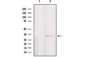 Western blot analysis of extracts from HepG2, using PPP1R3D Antibody. (PPP1R3D 抗体  (Internal Region))