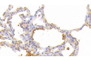 Detection of JAK3 in Human Lung Tissue using Polyclonal Antibody to Janus Kinase 3 (JAK3) (JAK3 抗体  (AA 716-967))