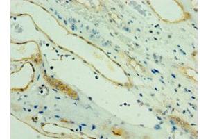 Immunohistochemistry of paraffin-embedded human kidney tissue using ABIN7164273 at dilution of 1:100 (PARL 抗体  (AA 1-170))