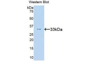 Western Blotting (WB) image for anti-Signal Transducer and Activator of Transcription 6, Interleukin-4 Induced (STAT6) (AA 262-520) antibody (ABIN1860655) (STAT6 抗体  (AA 262-520))