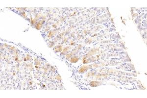 Detection of DGKz in Mouse Stomach Tissue using Polyclonal Antibody to Diacylglycerol Kinase Zeta (DGKz) (DGKZ 抗体  (AA 657-879))