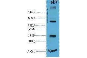 Western Blotting (WB) image for anti-EF-Hand Domain Family, Member D1 (EFHD1) antibody (ABIN3181263) (EFHD1 抗体)