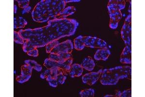IF analysis of TFRC using anti-TFRC antibody (ABIN3043538). (Transferrin Receptor 抗体  (AA 1-198))