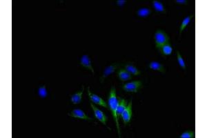 Immunofluorescent analysis of Hela cells using ABIN7149094 at dilution of 1:100 and Alexa Fluor 488-congugated AffiniPure Goat Anti-Rabbit IgG(H+L) (CYBB 抗体  (AA 283-570))