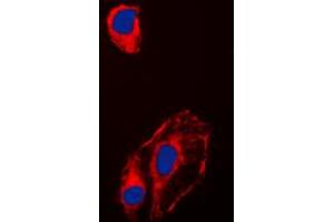 Immunofluorescent analysis of HSP90 beta (pS254) staining in HeLa cells. (HSP90AB1 抗体  (pSer254))