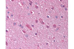 Anti-GABRQ antibody IHC of human brain, cortex. (GABRQ 抗体  (AA 31-80))
