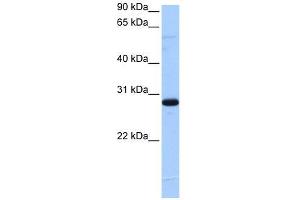 C1orf83 antibody used at 5 ug/ml to detect target protein. (TCEANC2 抗体  (N-Term))