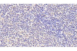 Detection of zAP70 in Human Lymph node Tissue using Polyclonal Antibody to Zeta Chain Associated Protein Kinase 70 kDa (zAP70) (ZAP70 抗体  (AA 337-600))