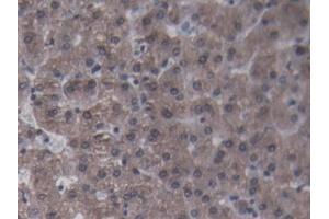DAB staining on IHC-P; Samples: Porcine Liver Tissue (CRP 抗体  (AA 20-222))