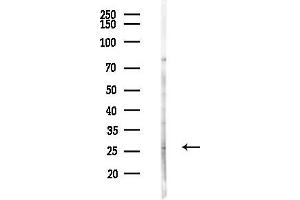 anti-WNT1 Inducible Signaling Pathway Protein 2 (WISP2) (C-Term) antibody