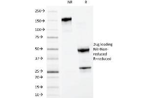 SDS-PAGE Analysis Purified MYDAM Monoclonal Antibody (MYADM/972). (MYADM 抗体)