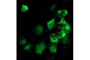 Anti-ANKRD53 mouse monoclonal antibody (ABIN2454288) immunofluorescent staining of COS7 cells transiently transfected by pCMV6-ENTRY ANKRD53 (RC206701). (ANKRD53 抗体  (AA 1-300))