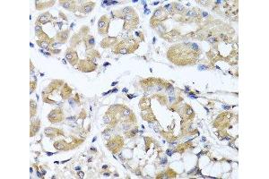 Immunohistochemistry of paraffin-embedded Human stomach using IFNL1 Polyclonal Antibody at dilution of 1:100 (40x lens). (IL29 抗体)