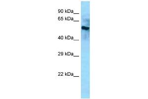 Western Blotting (WB) image for anti-beta-Carotene Oxygenase 2 (BCO2) (Middle Region) antibody (ABIN2788504) (BCO2 抗体  (Middle Region))