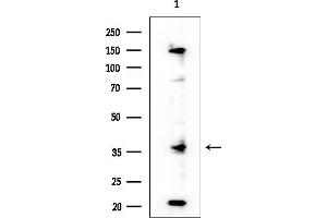 anti-Interleukin 12 beta (IL12B) (C-Term) antibody