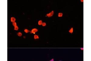 Immunofluorescence analysis of SH-SY5Y cells using CDK5R1 Polyclonal Antibody at dilution of 1:100. (CDK5R1 抗体)