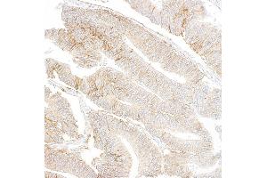 Immunohistochemistry (IHC) image for anti-Insulin-Like Growth Factor 1 Receptor (IGF1R) antibody (ABIN7795597)