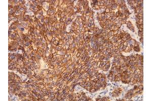 Immunohistochemistry (IHC) image for anti-Receptor tyrosine-protein kinase erbB-2 (ErbB2/Her2) (C-Term) antibody (ABIN870539) (ErbB2/Her2 抗体  (C-Term))