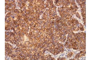 Immunohistochemistry (IHC) image for anti-Receptor tyrosine-protein kinase erbB-2 (ErbB2/Her2) (C-Term) antibody (ABIN870541) (ErbB2/Her2 抗体  (C-Term))