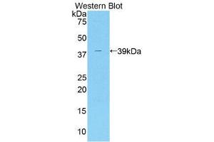 Western Blotting (WB) image for anti-ArfGAP with Dual PH Domains 2 (ADAP2) (AA 49-361) antibody (ABIN1858367)