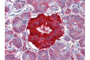 Pancreas, Human: Formalin-Fixed, Paraffin-Embedded (FFPE) (TTR 抗体)